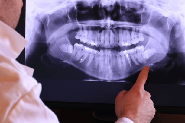 Best Emergency Tooth Extraction in Potomac Park, CA
