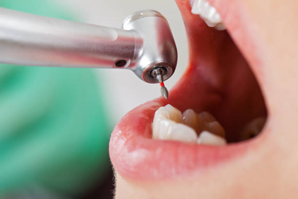 Best Urgent Dental Care in Potomac Park, CA